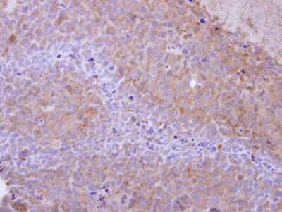 Immunohistochemistry-Paraffin: PPP6C Antibody [NBP2-19918]