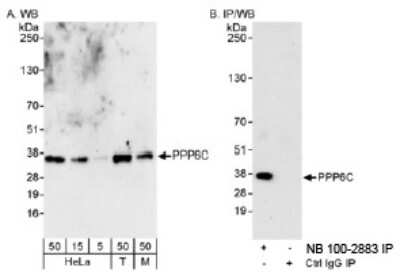 Western Blot: PPP6C Antibody [NB100-2883]