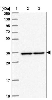 Western Blot: PPP6C Antibody [NBP2-13804]