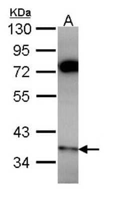 Western Blot: PPP6C Antibody [NBP2-19918]