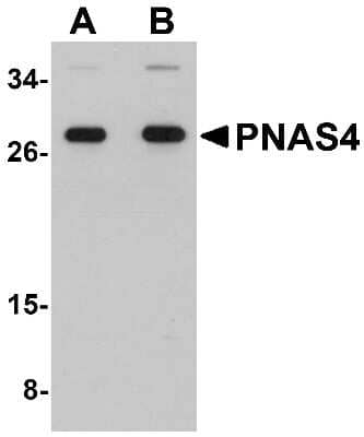 Western Blot: PPPDE1 AntibodyBSA Free [NBP1-76320]