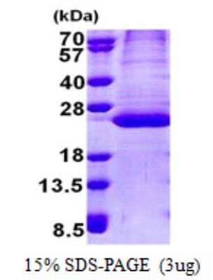 SDS-PAGE: Recombinant Human PPPDE2 His Protein [NBP2-22996]