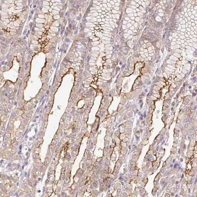 Immunohistochemistry: PPPDE2 Antibody [NBP2-47324]