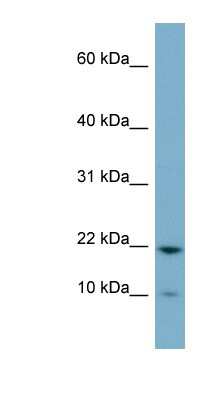 Western Blot: PPPDE2 Antibody [NBP1-56495]