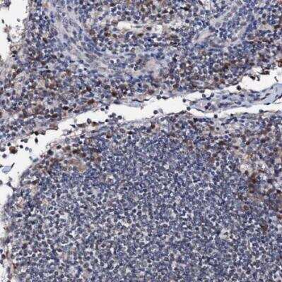 Immunohistochemistry-Paraffin: PPRC1 Antibody [NBP1-82985]