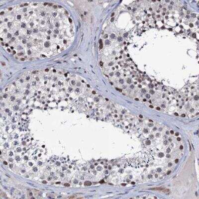 Immunohistochemistry-Paraffin: PPRC1 Antibody [NBP1-82985]