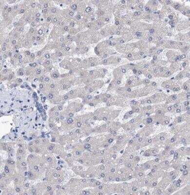 Immunohistochemistry-Paraffin: PPRC1 Antibody [NBP1-82985]