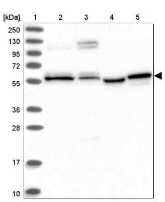 Western Blot: PPRC1 Antibody [NBP1-82985]