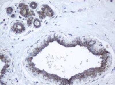 Immunohistochemistry-Paraffin: PPT1 Antibody (OTI1F10) [NBP2-45388]