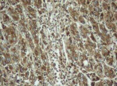 Immunohistochemistry-Paraffin: PPT1 Antibody (OTI1F10) [NBP2-45388]