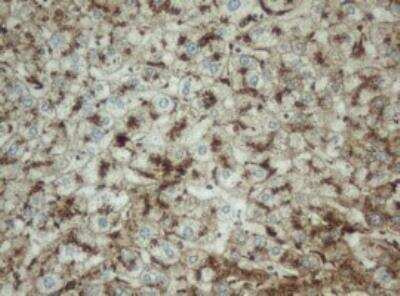 Immunohistochemistry-Paraffin: PPT1 Antibody (OTI1F10) [NBP2-45388]