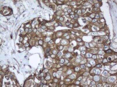 Immunohistochemistry-Paraffin: PPT1 Antibody (OTI1F10) [NBP2-45388]