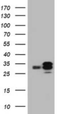 Western Blot: PPT1 Antibody (OTI1F10) [NBP2-45388]