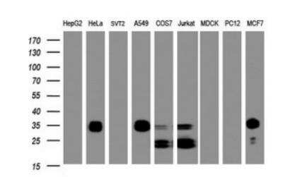 Western Blot: PPT1 Antibody (OTI1F10) [NBP2-45388]