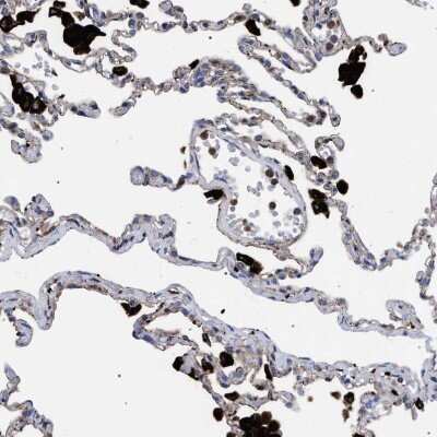 Immunohistochemistry-Paraffin: PPT1 Antibody [NBP1-85563]