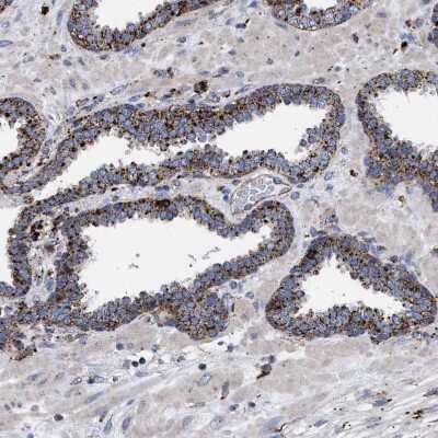 Immunohistochemistry-Paraffin: PPT1 Antibody [NBP1-85563]