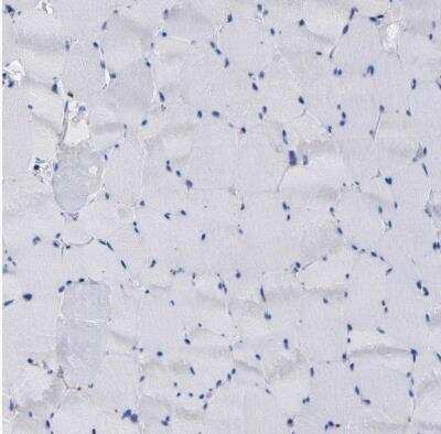 Immunohistochemistry-Paraffin: PPT1 Antibody [NBP1-85563]