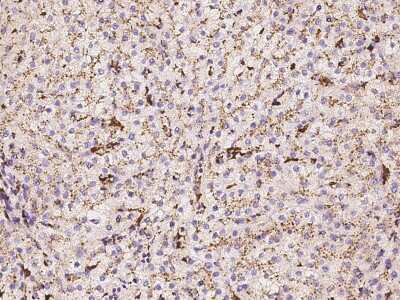 Immunohistochemistry-Paraffin: PPT1 Antibody [NBP2-97410]