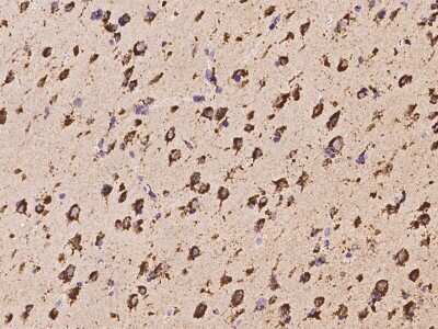 Immunohistochemistry-Paraffin: PPT1 Antibody [NBP2-97410]