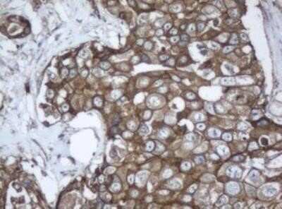 Immunohistochemistry: PPT1 Antibody (OTI1F10) - Azide and BSA Free [NBP2-73588]