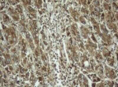 Immunohistochemistry: PPT1 Antibody (OTI1F10) - Azide and BSA Free [NBP2-73588]