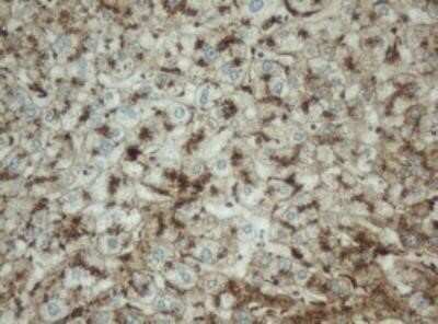 Immunohistochemistry: PPT1 Antibody (OTI1F10) - Azide and BSA Free [NBP2-73588]