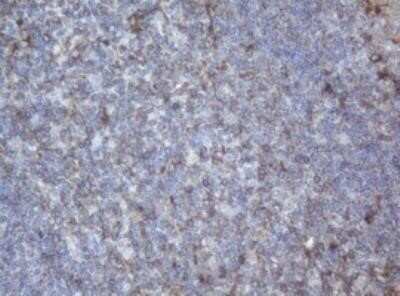 Immunohistochemistry: PPT1 Antibody (OTI1F10) - Azide and BSA Free [NBP2-73588]