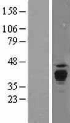 Western Blot: PPT1 Overexpression Lysate [NBL1-14713]