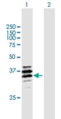 Western Blot: PPT2 Antibody [H00009374-B01P]