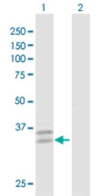 Western Blot: PPT2 Antibody [H00009374-D01P]