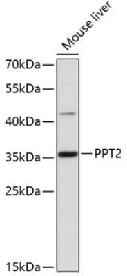 Western Blot: PPT2 AntibodyAzide and BSA Free [NBP2-94272]