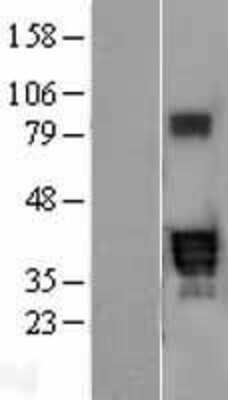 Western Blot: PPT2 Overexpression Lysate [NBL1-14714]