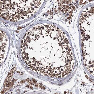 Immunohistochemistry-Paraffin: PPTC7 Antibody [NBP1-90654]