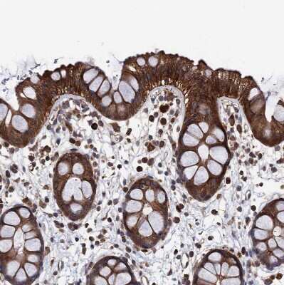 Immunohistochemistry-Paraffin: PPTC7 Antibody [NBP1-90654]