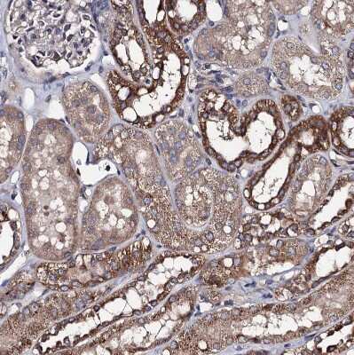 Immunohistochemistry-Paraffin: PPTC7 Antibody [NBP1-90654]
