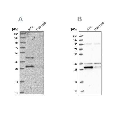 Western Blot: PPTC7 Antibody [NBP1-90653]