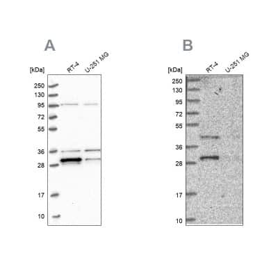 Western Blot: PPTC7 Antibody [NBP1-90654]