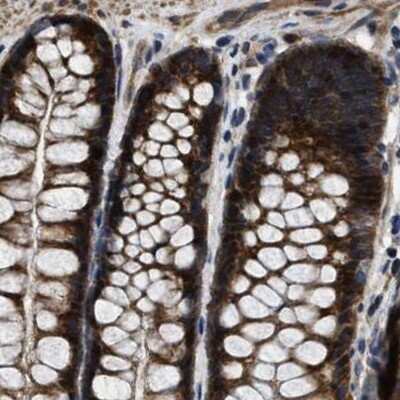 Immunohistochemistry-Paraffin: PPWD1 Antibody [NBP1-83049]