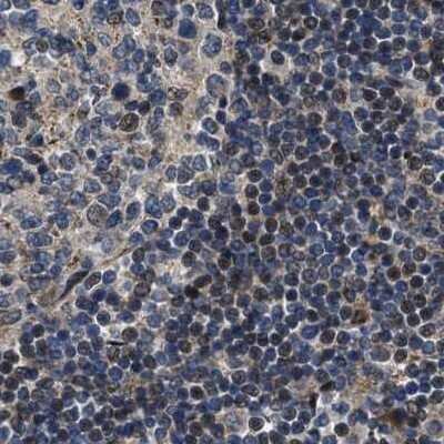 Immunohistochemistry-Paraffin: PPWD1 Antibody [NBP1-83049]
