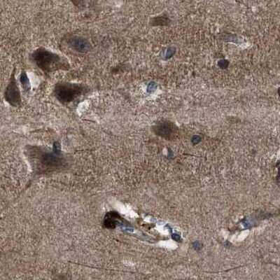 Immunohistochemistry-Paraffin: PPWD1 Antibody [NBP1-83050]