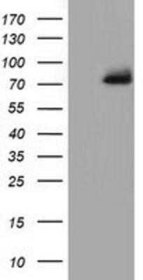 Western Blot: PPWD1 Antibody (OTI1B8)Azide and BSA Free [NBP2-73590]