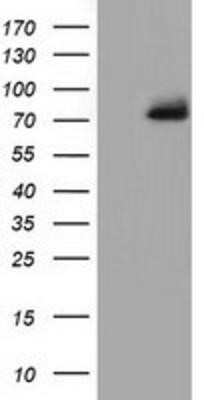 Western Blot: PPWD1 Antibody (OTI1B8) [NBP2-03224]