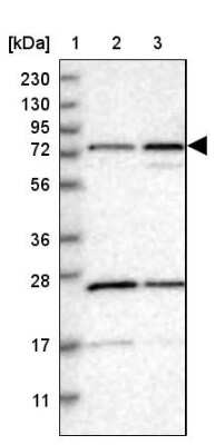 Western Blot: PPWD1 Antibody [NBP1-83050]