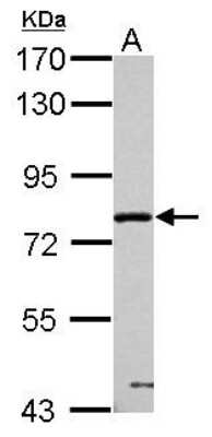 Western Blot: PPWD1 Antibody [NBP2-19919]