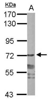 Western Blot: PPWD1 Antibody [NBP2-19919]