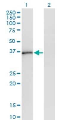 Western Blot: PQBP1 Antibody (1A11) [H00010084-M01]