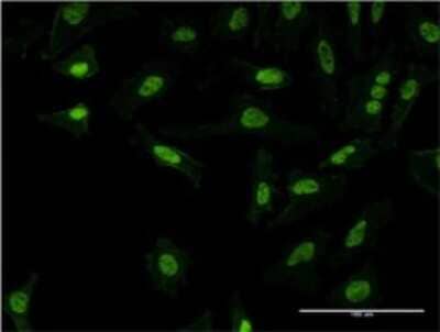 Immunocytochemistry/ Immunofluorescence: PQBP1 Antibody (3H7) [H00010084-M15]