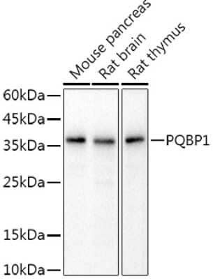 Western Blot: PQBP1 Antibody (8D8H6) [NBP3-16075]