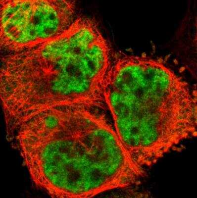 Immunocytochemistry/ Immunofluorescence: PQBP1 Antibody [NBP1-82619]