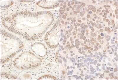 Immunohistochemistry: PQBP1 Antibody [NBP1-47270]
